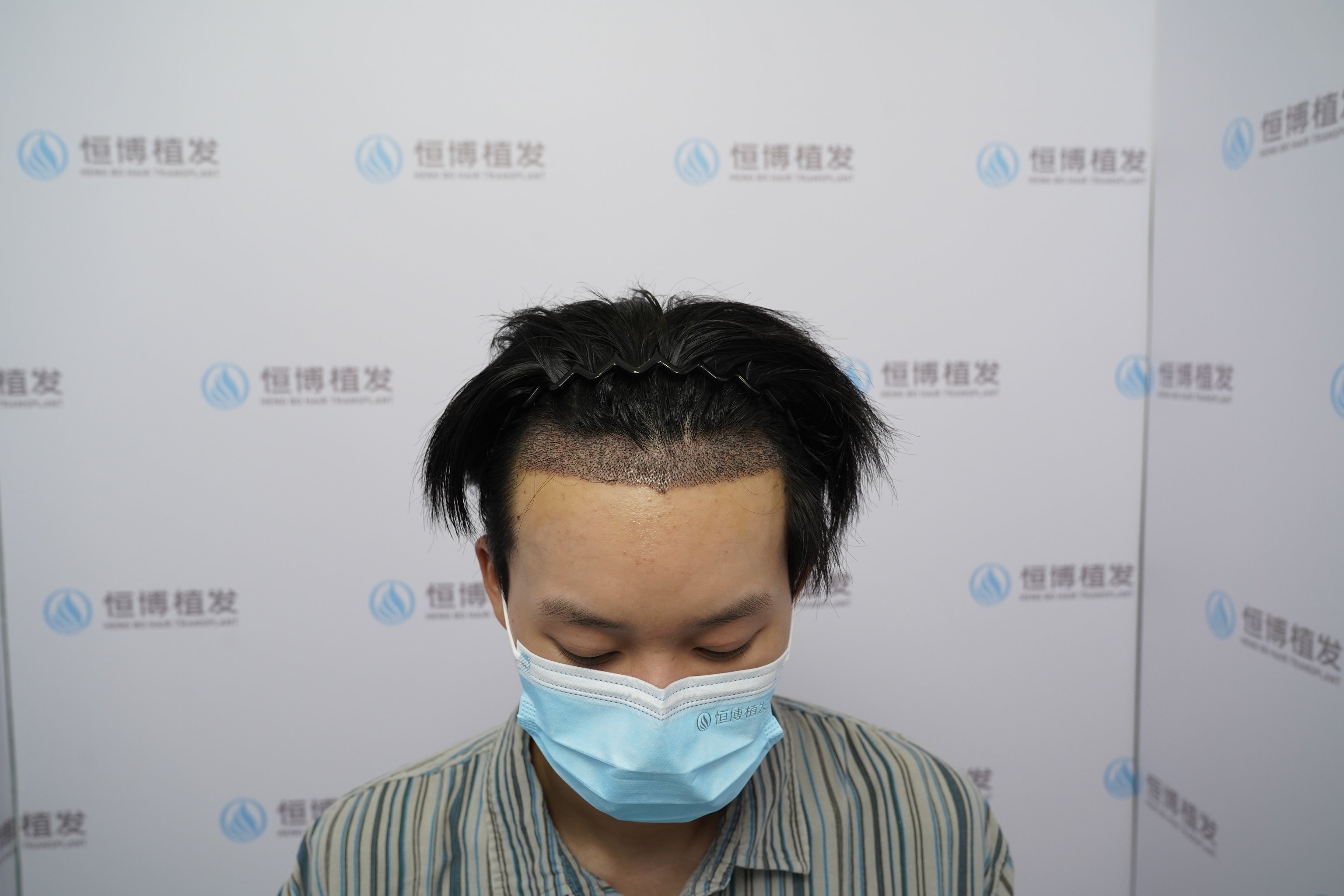 发现一家宝藏植发机构