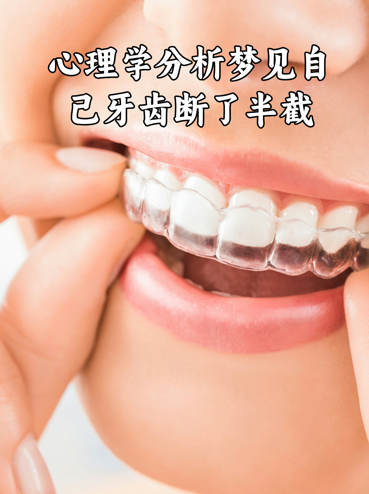 周公解梦，梦见绊断牙齿的深层寓意与心理解析