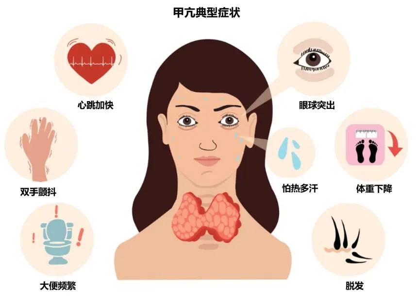 注意！这 7 种人是甲亢高危人群，要小心了！