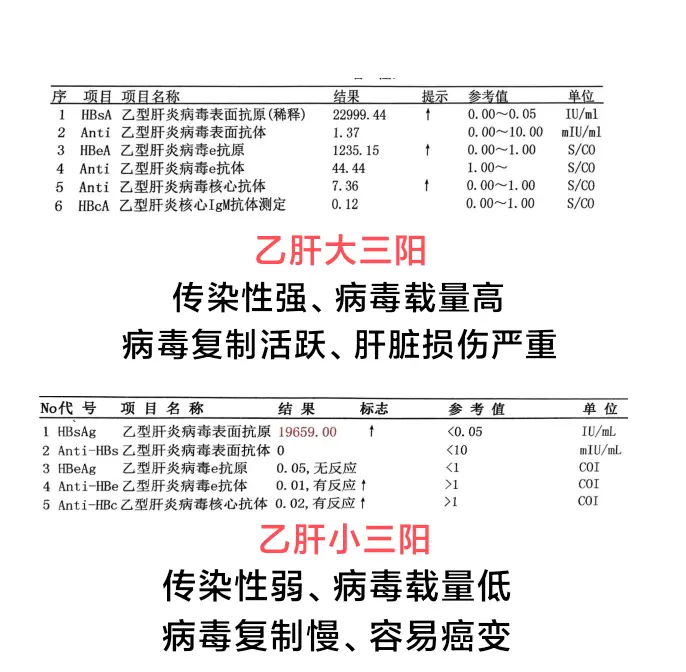 大三阳害他人，小三阳害自己！ 在门诊上总有一些患者问我，大三阳害他人...