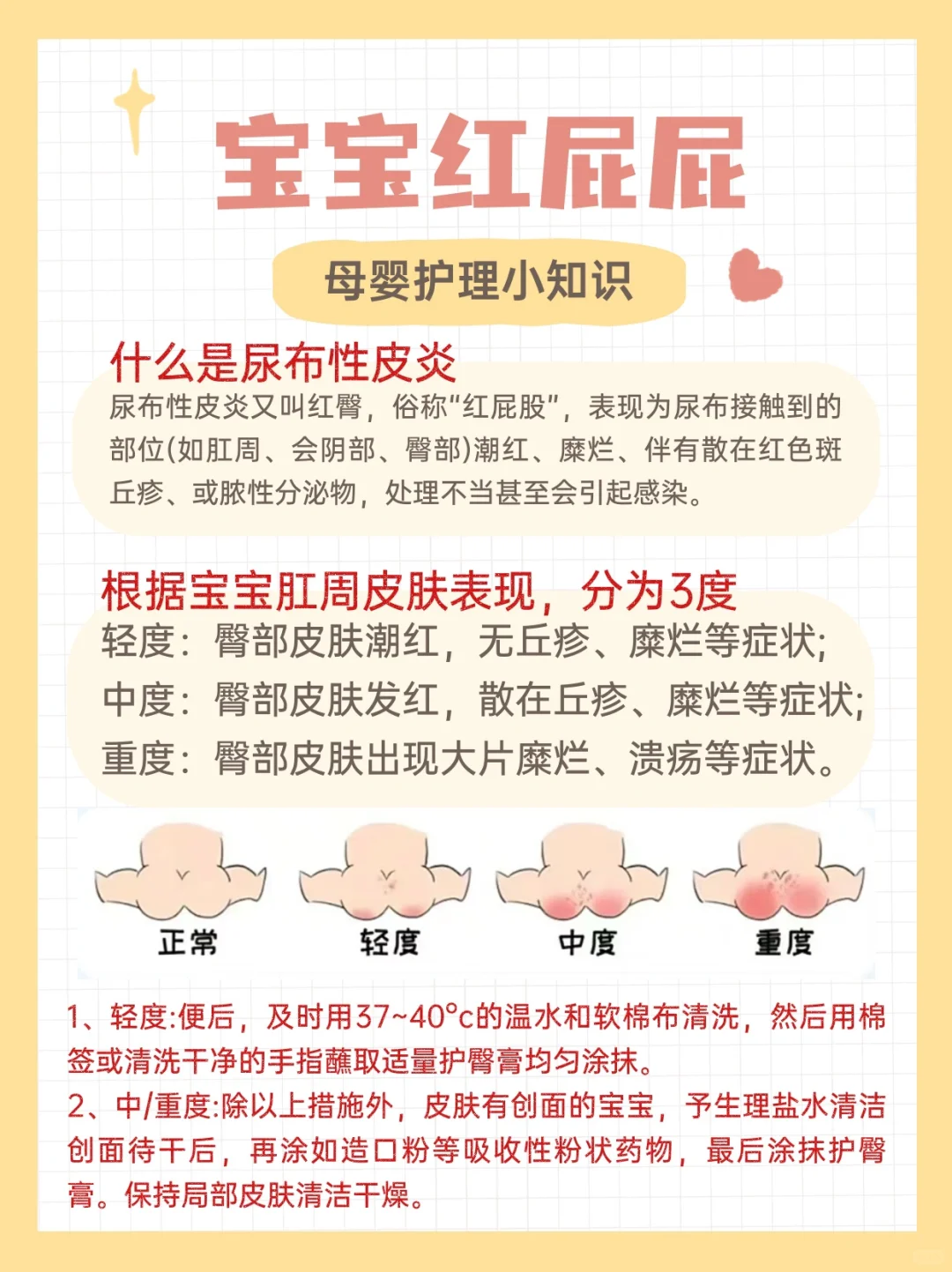 母婴育儿知识｜宝宝红屁屁如何护理