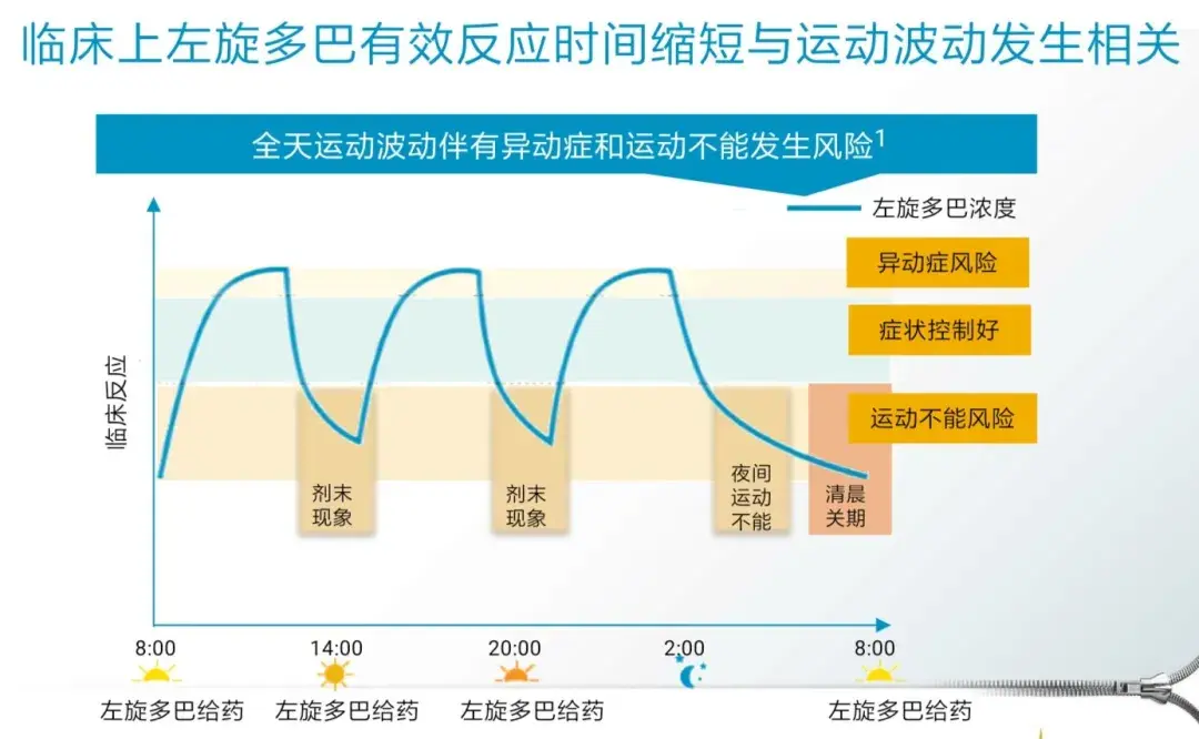 当服用美多芭超过一个小时左右，这5个症状有明显下降，也就意味患者该调药了！