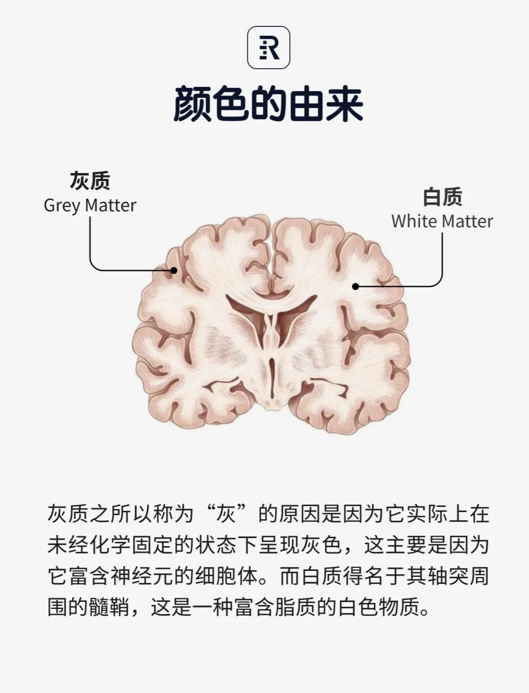 名词解释灰质和白质